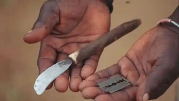 Father of baby whose genitals were chop-off ask for help